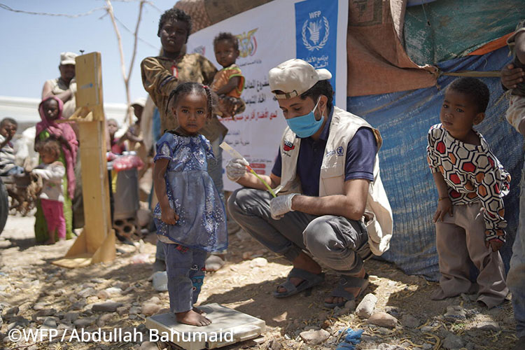 イエメンで栄養不良の検診を受ける2歳半の女の子